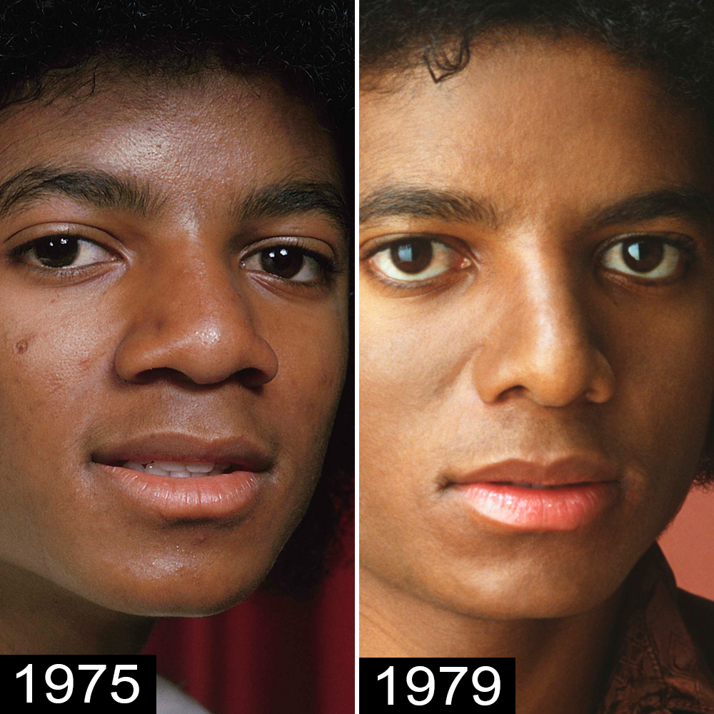 michael jackson nose progression