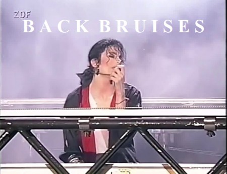 Michael Jackson Munich 1999 Accident