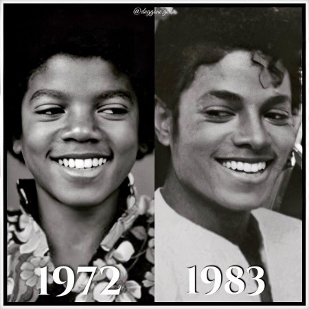 michael jackson before and after nose job